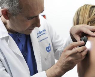 Cáncer de piel 5 martinez escribano cancer piel