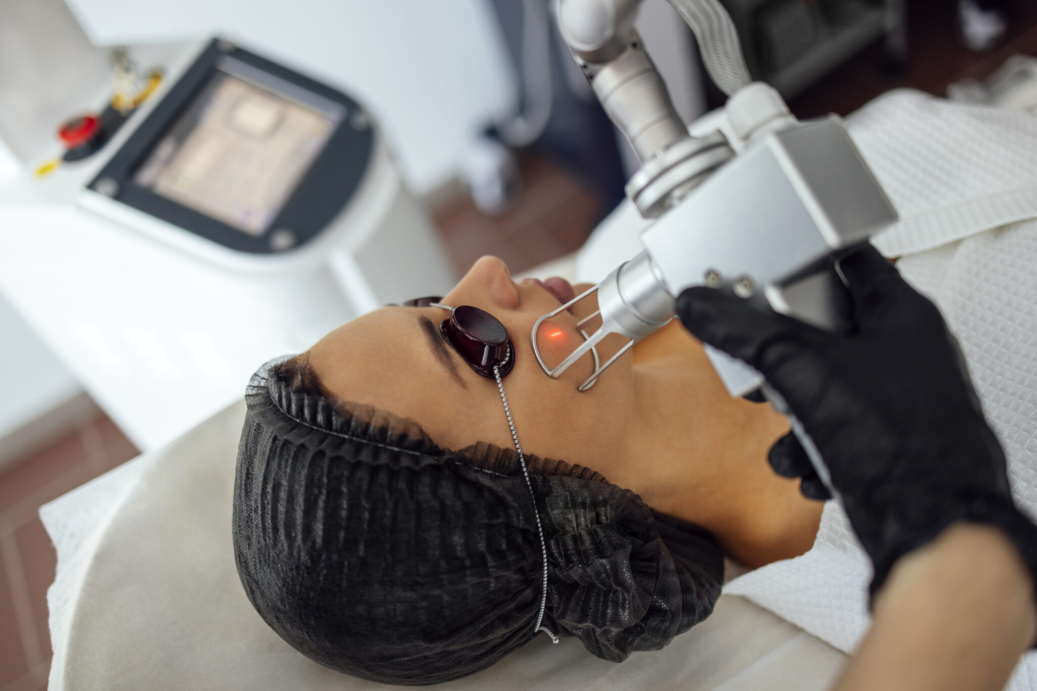 Closeup of the face of young woman undergoing laser resurfacing and peeling procedure in spa salon. Cosmetologist female client closed her eyes and rests during laser facial rejuvenation.