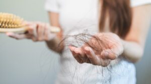 Caída del cabello: qué puede revelar la tricoscopia antes de empezar un tratamiento 1 Caída del cabello