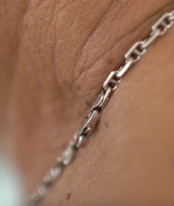 Verrugas en el cuello: por qué no todo lo que parece una verruga lo es 1 Captura de pantalla 2026 10 16 a las 12.38.48 e1792147292669