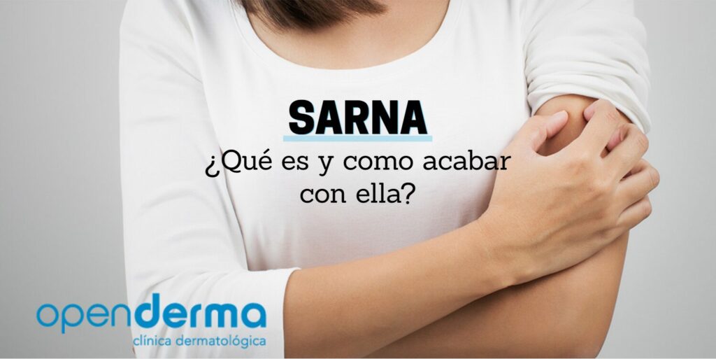 ¿Qué es la Sarna? 4 sarna que es openderma murcia