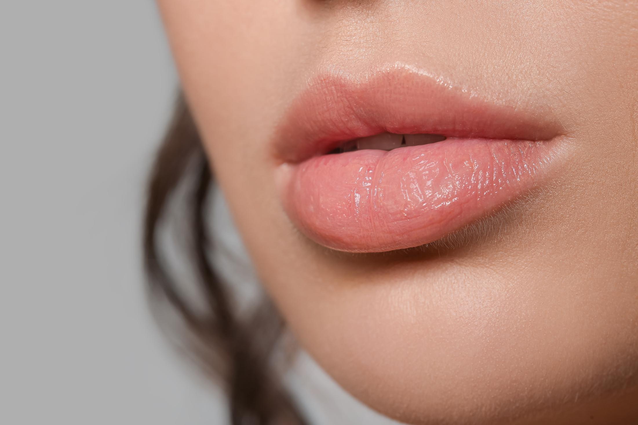 3.2. LABIOS_ESTETICA_OPENDERMA MURCIA
