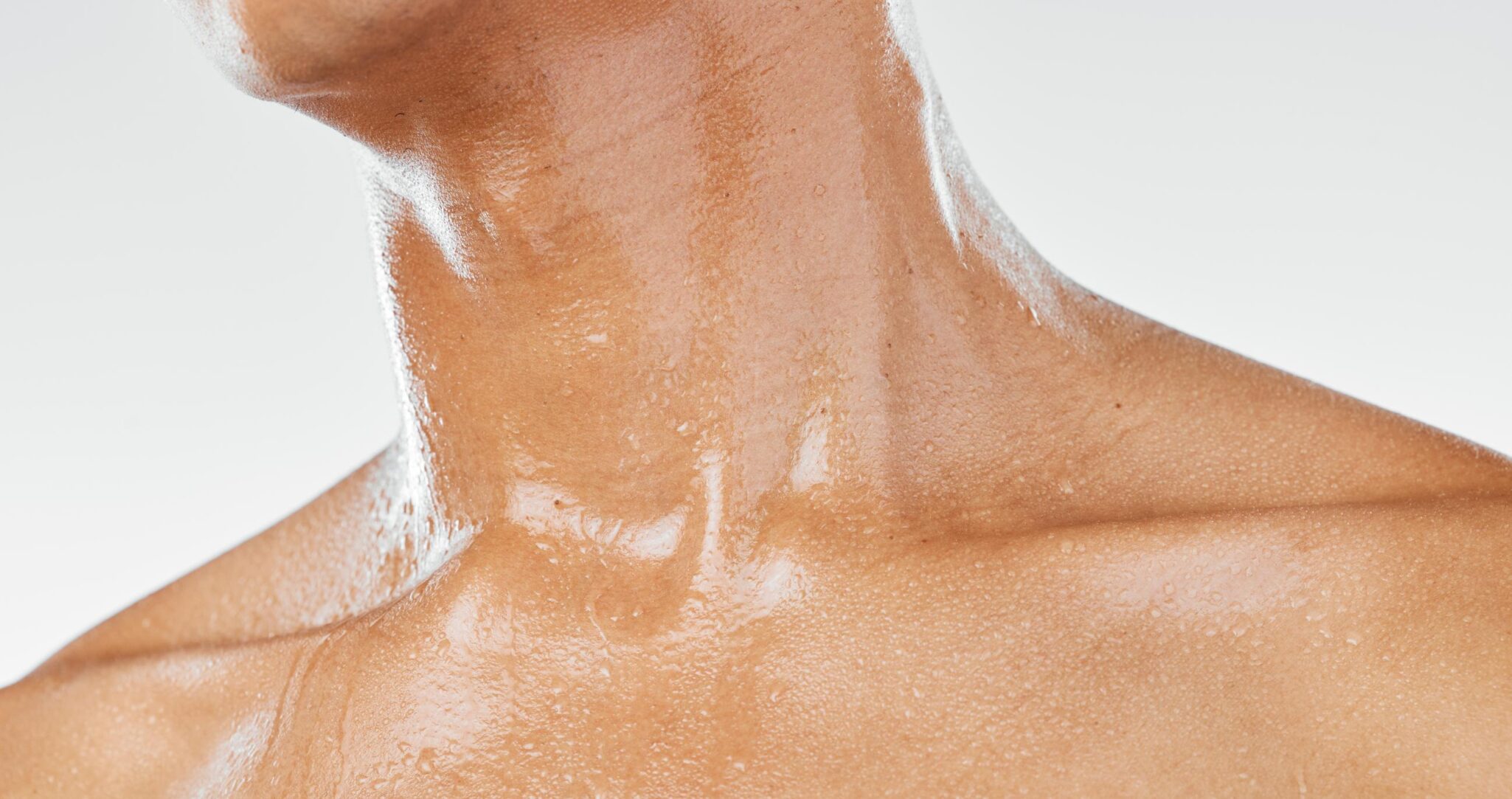 hiperhidrosis-openderma-dermatologo-murcia (3)