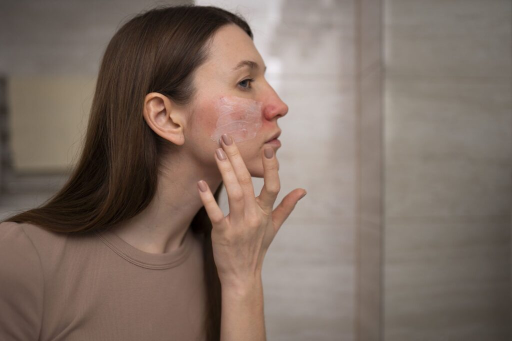 Rosácea: cara roja y piel sensible. Tratamiento y prevención. 1 dermatologo murcia