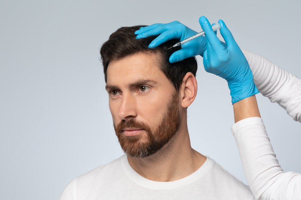 Tratamiento para la caída capilar en Murcia con mesoterapia en clínica dermatológica OPENDERMA